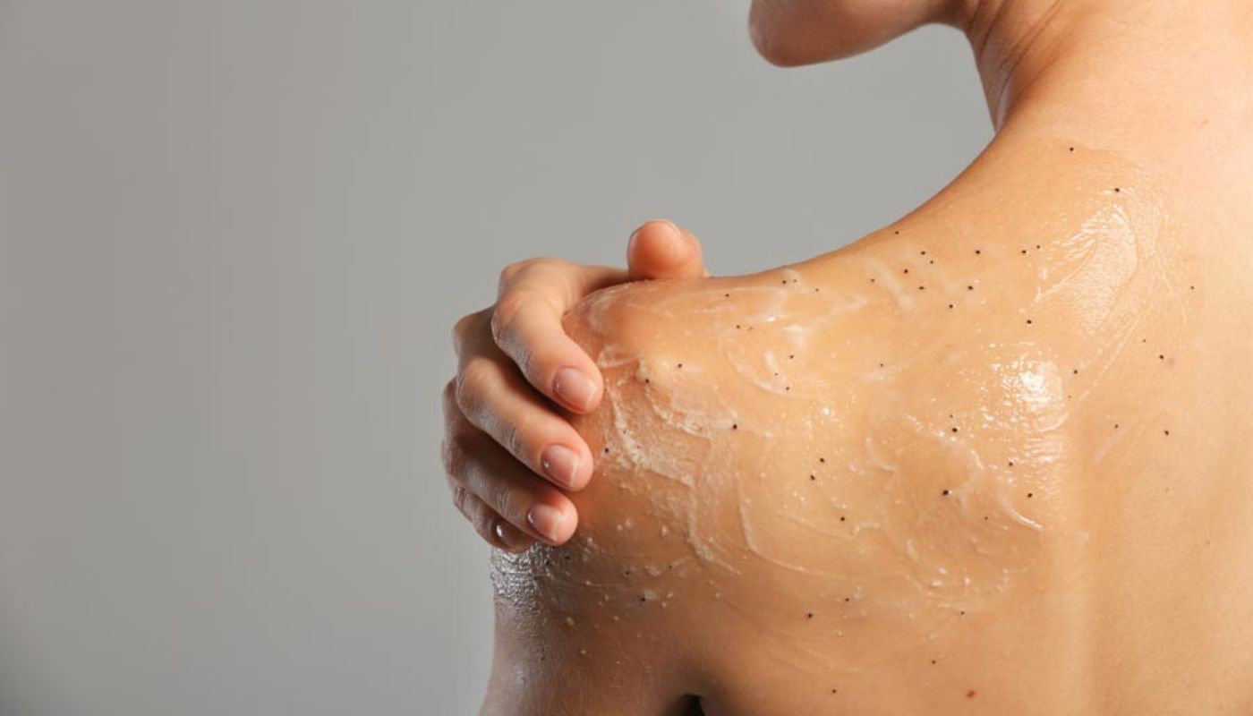 Esfoliazione
