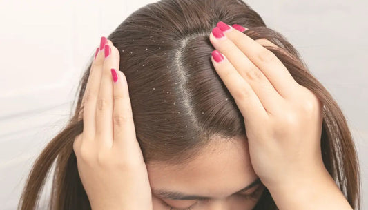 Prodotti per forfora