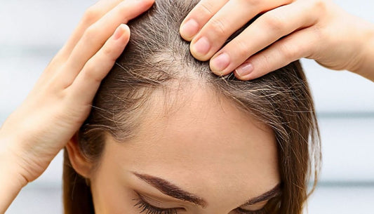 Prodotti per capelli diradati