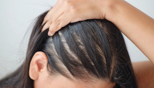 Prodotti per capelli grassi