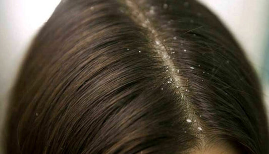 Shampoo per la forfora