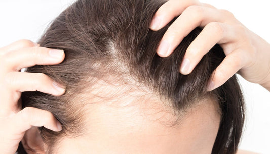 Trattamento anticaduta capelli