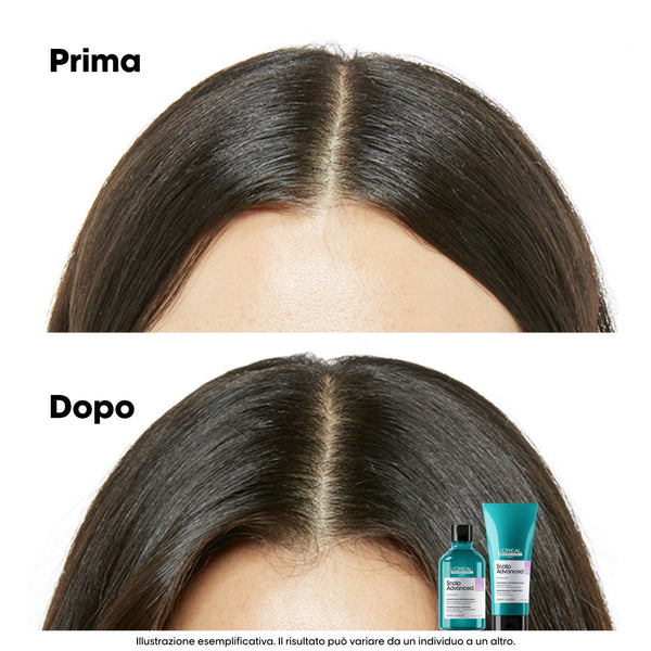 L'oreal serie expert scalp advance refill shampoo anti inconfort-discomfort - shampoo lenitivo per cute sensibile