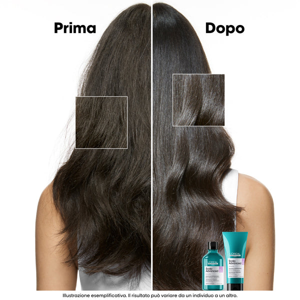 L'oreal serie expert scalp advance refill shampoo anti inconfort-discomfort - shampoo lenitivo per cute sensibile